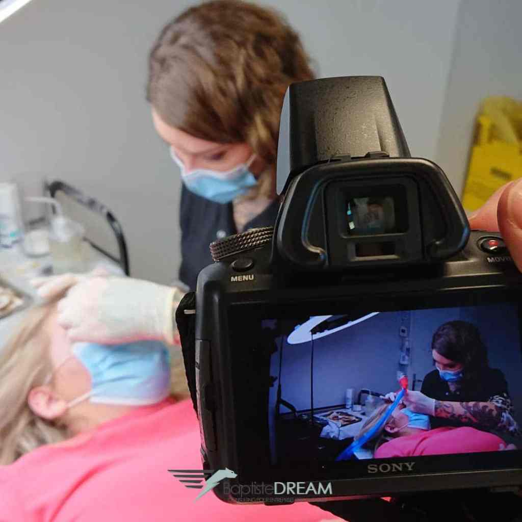 Perfect DERMO shooting